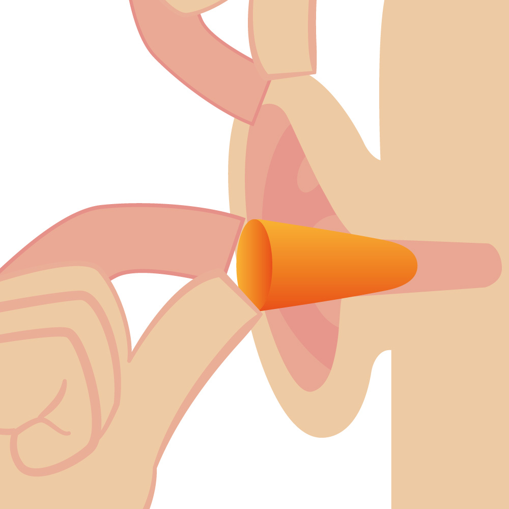 Illustration de l'insertion d'un bouchon d'oreilles jetable non modulable dans le canal auditif